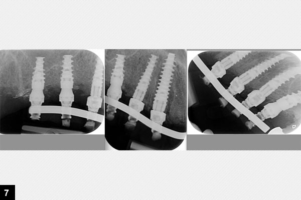 radiographie de contrle