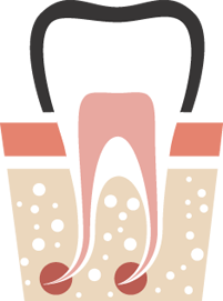 endodontie