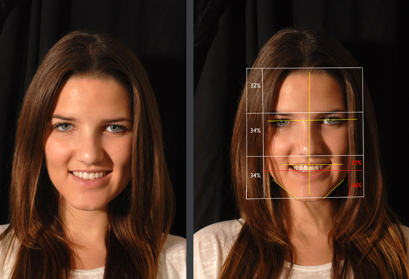 types de sourire