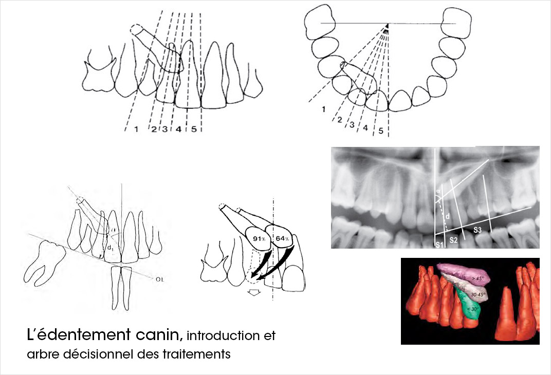 édentement canin