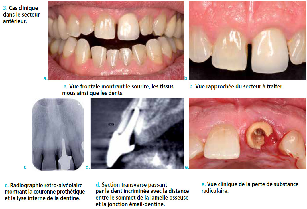 guide à la décision thérapeutique