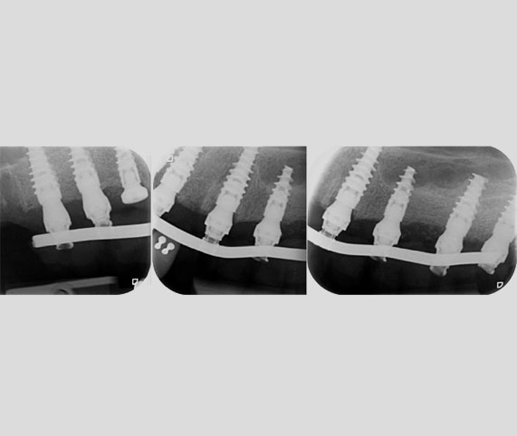 contrôle radiographique