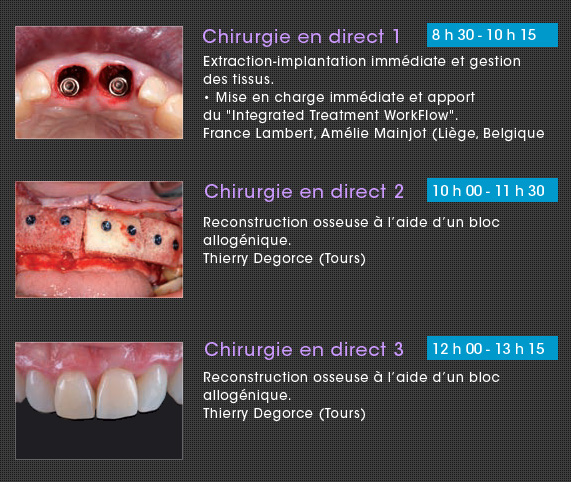 management des tissus durs et mous