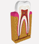 endodontie