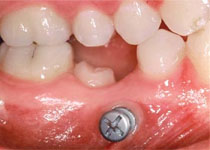 orthodontie