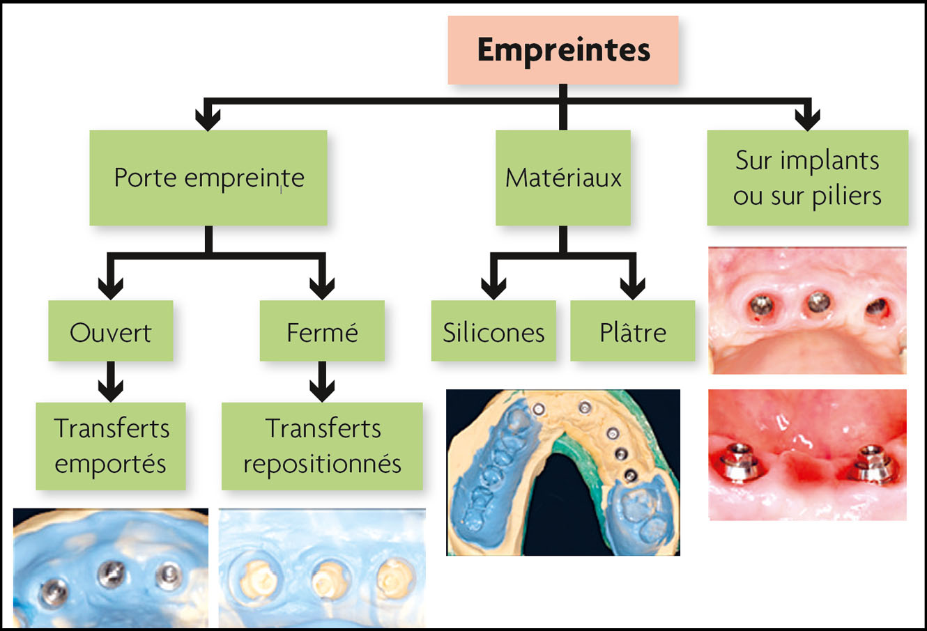 Transfert d'empreinte