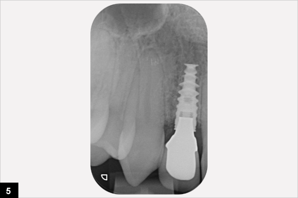 radiographie