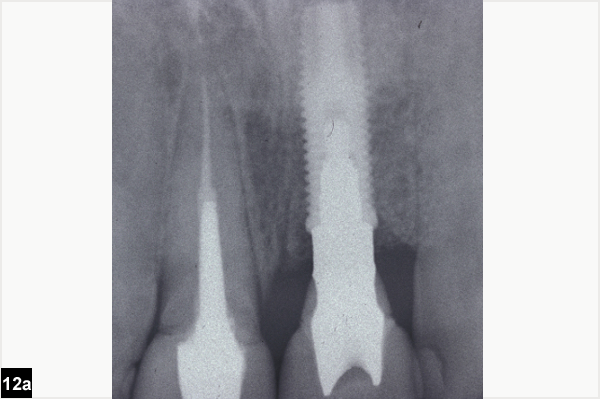 radiographie