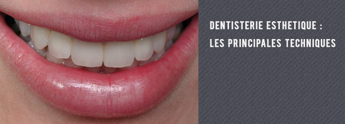 dentisterie esthétique