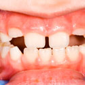 dentisterie pédiatrique, pedodontie