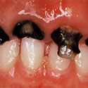soins dentaires