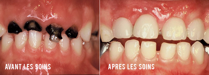 soins dentaires