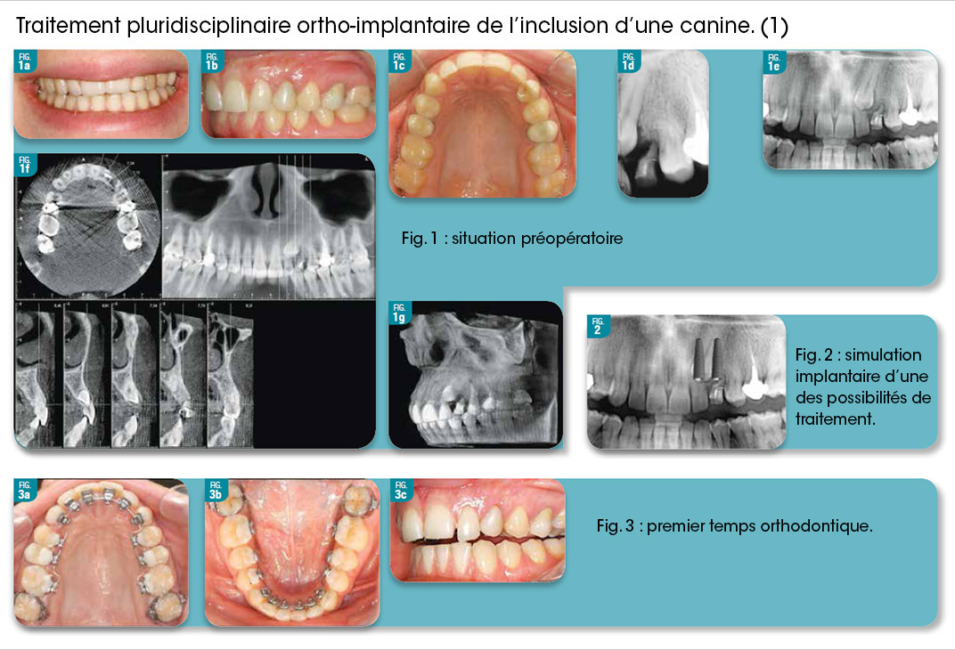 édentement canin
