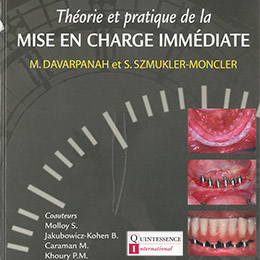 mise en charge immédiate