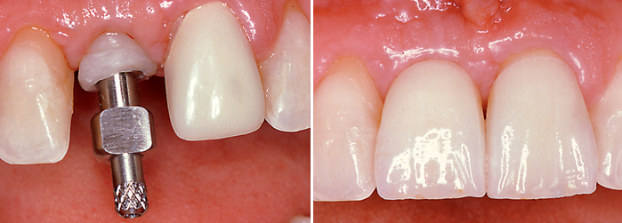 esthetique dentaire