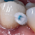 hygiene dentaire