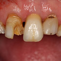 pathologies bucco dentaires
