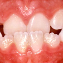 dossier orthodontique