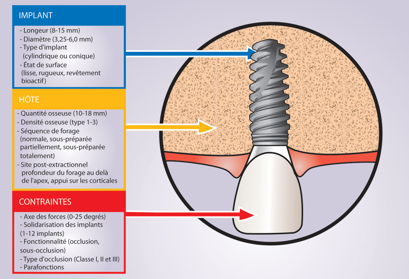 interface os implant