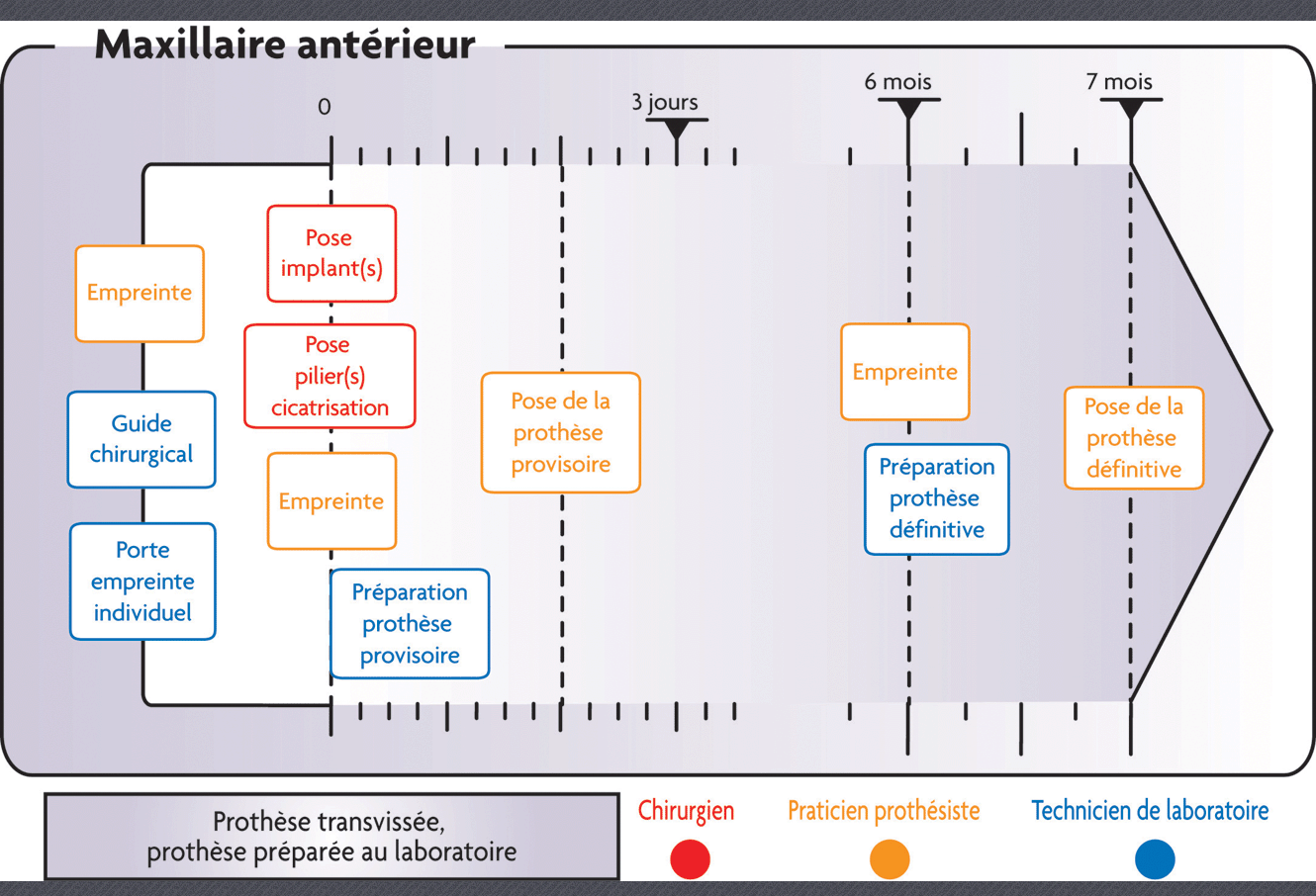 prothèse fixe, temporisation