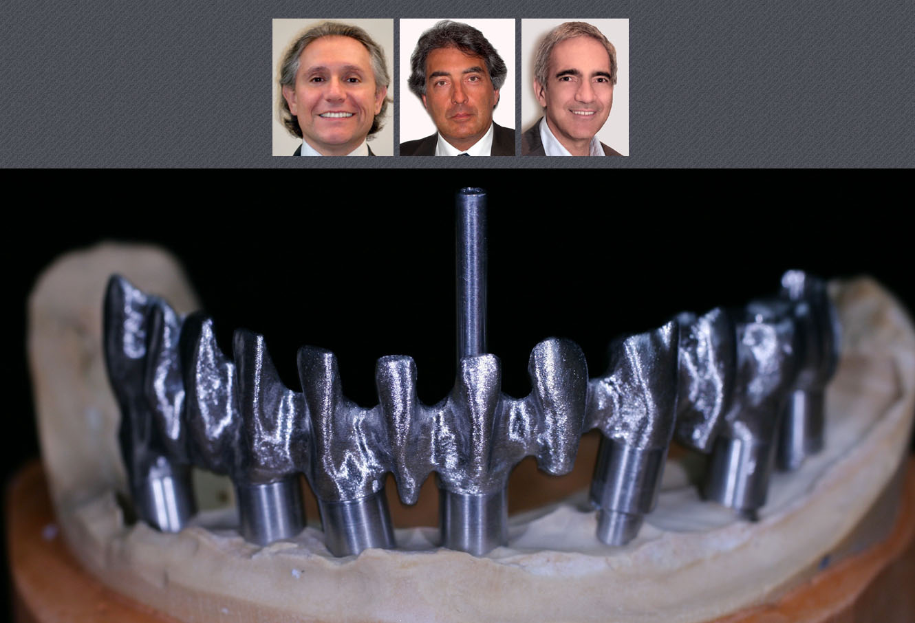 mise en charge immédiate des implants