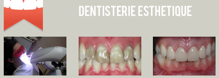 dentisterie esthetique