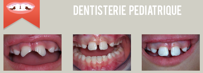 dentisterie pediatrique