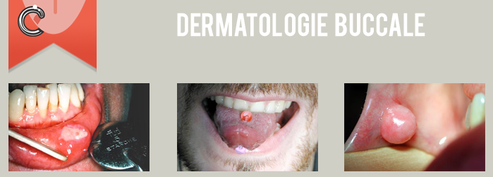 dermatologie buccale