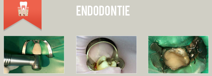 endodontie