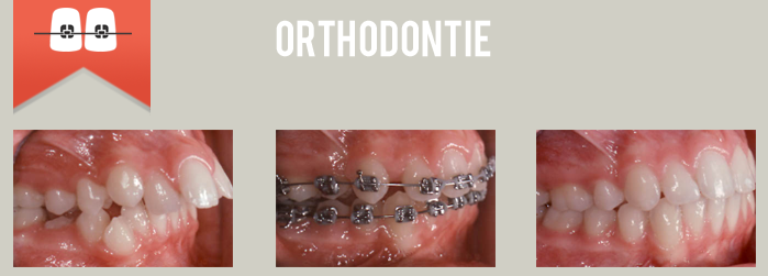 orthodontie